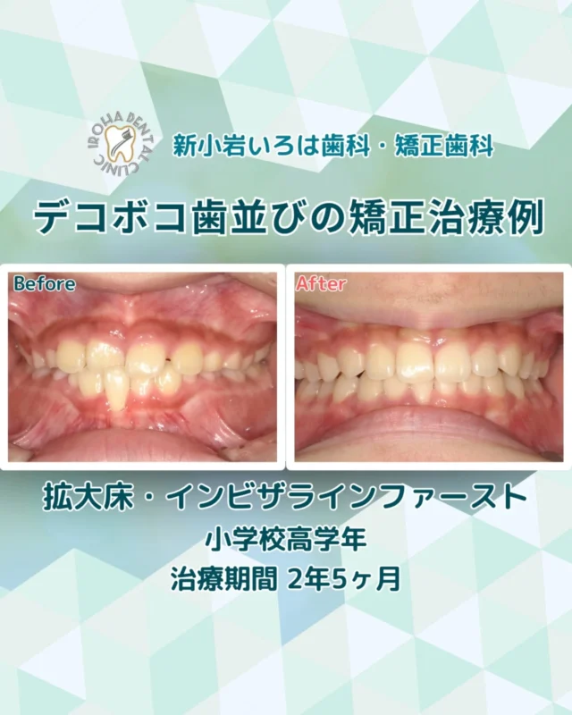 Instagram 投稿 17863176954528805